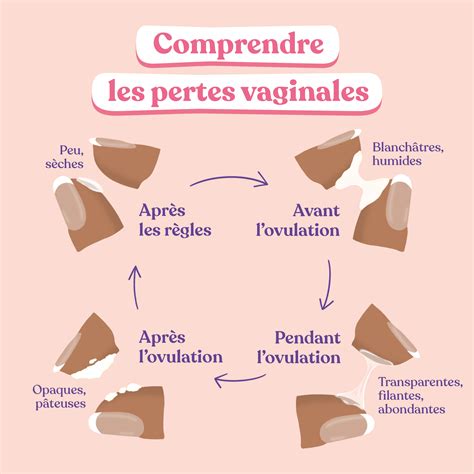 perte cremeuse|Pertes vaginales blanches, quand sinquiéter et quand。